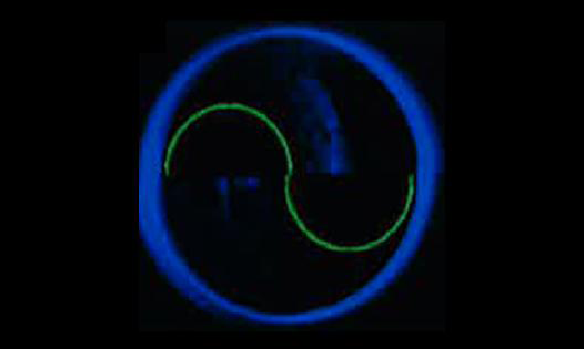 アプラネーション