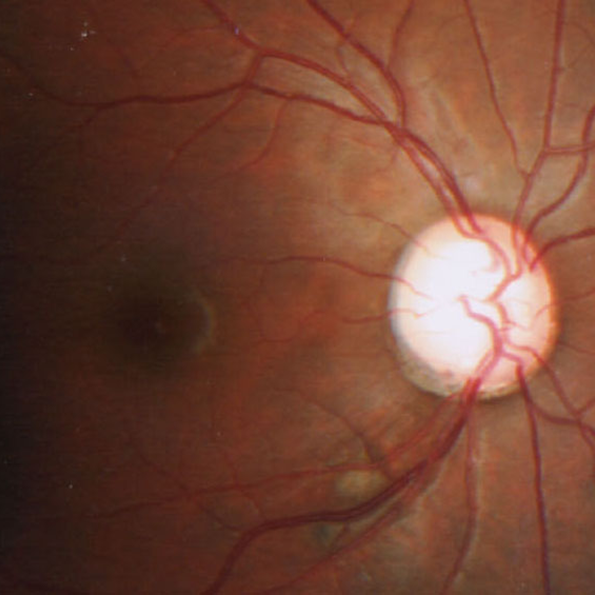 人間ドック・成人健診の結果について